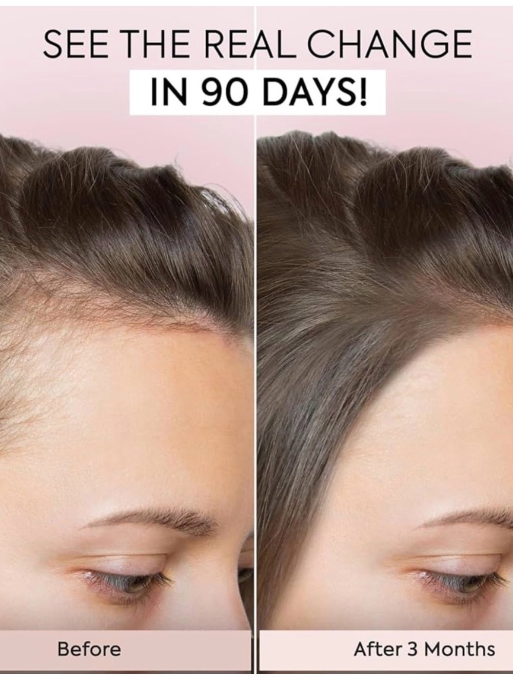 Vegamour GRO Hair Serum with Box most powerful - Picture 6 of 8